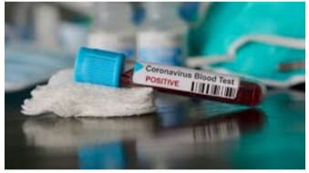 Kasus Positif Covid-19 di Aceh Selatan Kembali Bertambah 5 Orang