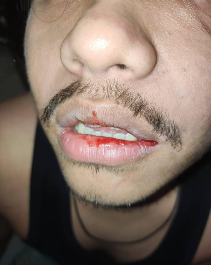 Karena Persoalan Parkir, Oknum TNI di Duga Aniaya Pelanggan Mie Gacoan  di Banda Aceh